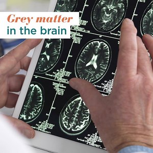 298 reactions · 124 shares | Research shows changes in the brain’s grey matter play a bigger role in multiple sclerosis (MS) than once believed. For people with MS, this new learning can have a real impact. | Multiple Sclerosis News Today | Facebook