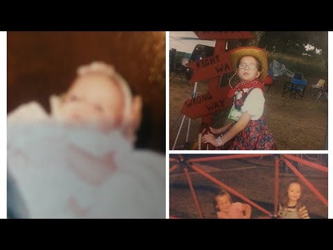 Sharing My Testimony!! Surviving A Serious Birth Defect!!