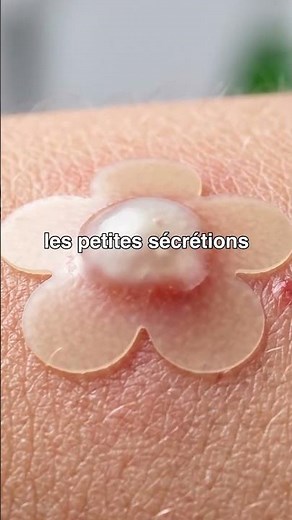 Les patchs contre l'acné