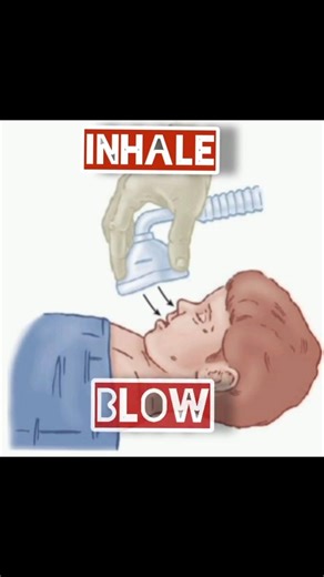 Instillation and Insufflation (local route of drug administration)