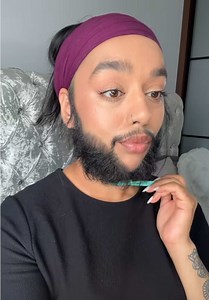 PCOS Hirsutism: Choosing Between Laser and Electrolysis for Facial Hair