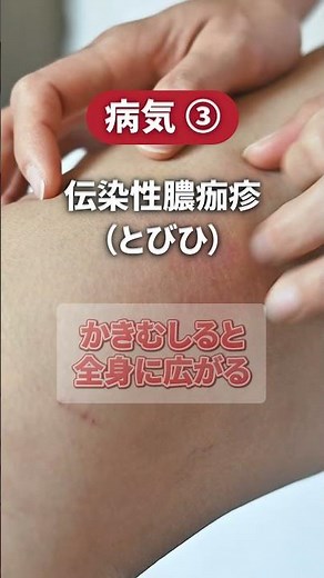 【プールで感染】夏に気をつけたい皮膚の病気