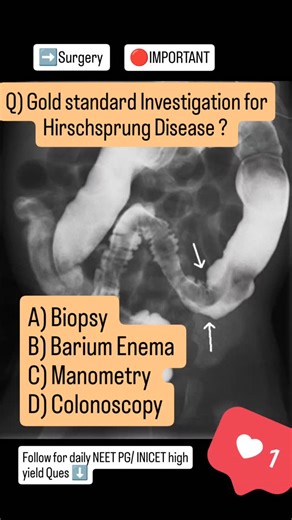Case2Concepts on Instagram: "Gold Std Investigation for Hirschsprung Disease?#neetpg #usmle #fmge #inicet"