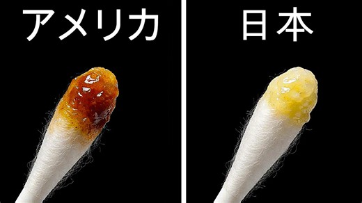 なぜアジア人は乾燥した耳垢を持つのか