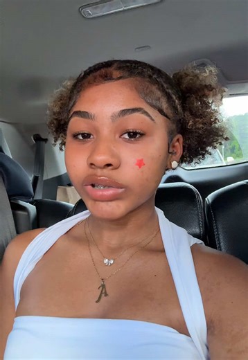 How to Treat Forehead Pimples Effectively