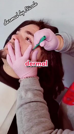 #bodymods #piercersoftiktok #cute #2021 #dermalpiercing #dermal#surgicalsteel #racinewi #femalepiercer ##cheekdermal #SimsSelves