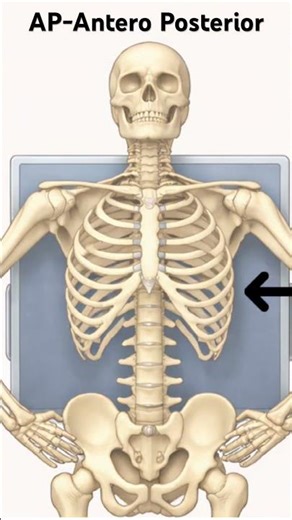 Positioning difference between AP & PA chest x- ray made simple. #radiography #xray #anatomy #medic