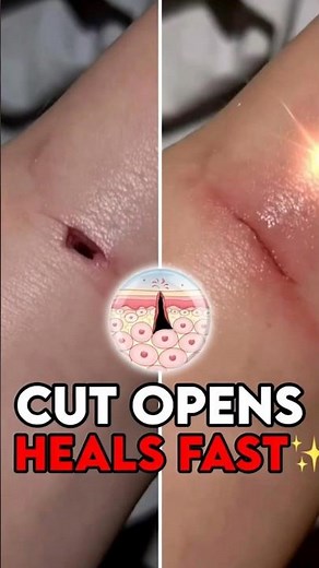How Your Skin Heals Cuts