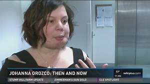 Cleveland woman speaks 9 years after being shot in face