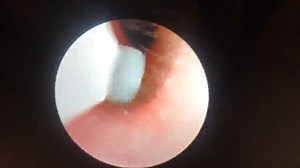 Watch ear cleaner camera on Amazon Live