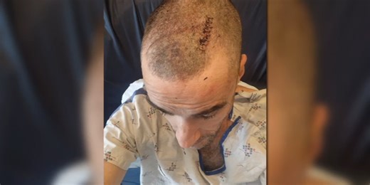 Security guard recovering from head injury after assault near the downtown Central Library