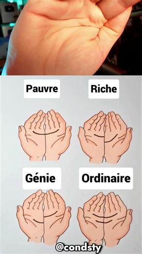 🍀Tu as de la chance ?