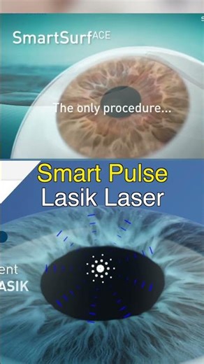 Blade less lasik silk, Best Eye Sergon in Jalandhar for Lasik #touchlesslasik #eyecare #eyes