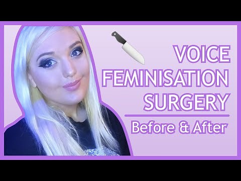 My Experience with Trans VOICE FEMINISATION SURGERY (Before & After)