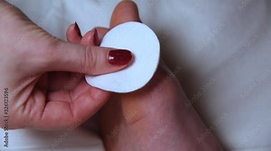 Injured leg in blood. Treatment of wounds on leg with anti-inflammatory ointment. First aid for abrasions. Close-up.