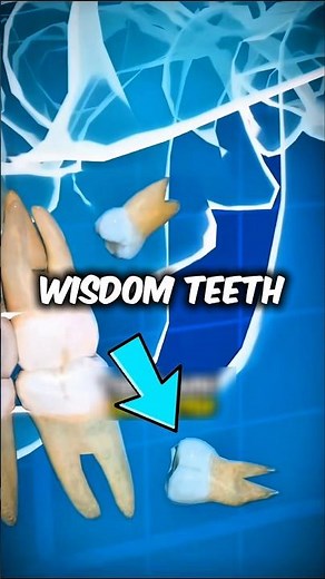 If you ever wondered why wisdom teeth hurt so much when they grow in