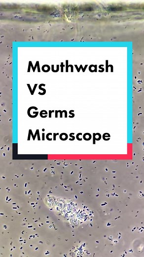 Mouthwash vs Germs: Microscope Insights