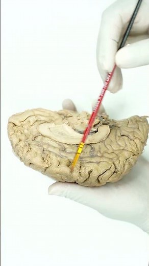 Central Sulcus of Rolando