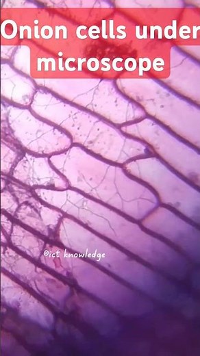 Seeing Onion Cells Through A Microscope