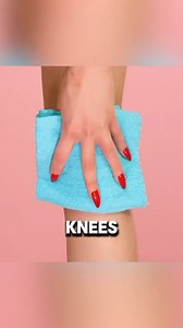 How to whiten dark knees and elbows naturally.#darkknees #darkelbows #naturalskincare | Mu Chen