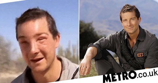 Bear Grylls' face swells after near-fatal bee sting reaction