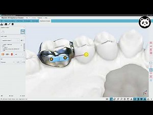 Maestro 3D | Dental Studio | Appliance Creator