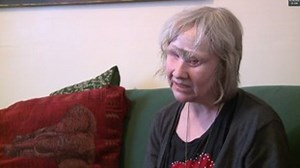 My dog ate part of my face but saved me from alcoholism