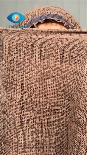 ‎سریتامد | تغییر رنـ ـگ چـ ـشم | ایـ ـمن و دائـ ـمی‎ on Instagram‎: "⁨ چشم‌ها اولین چیزی هستن که دیده می‌شن… و حالا می‌تونی اون‌ها رو برای همیشه تغییر بدی.😍👇 ‪@eye.color_change‬ با روش ETP، تغییر رنگ چشم به‌صورت ایمن، سرپایی و بدون بیهوشی در کمتر از نیم ساعت انجام می‌شه. پیگمنت‌ها به‌شکل کاملاً ایمن،دقیق و کنترل‌شده در لایه سطحی قرنیه قرار می‌گیرن، بدون آسیب به بینایی و بدون دستکاری داخل چشم. قبل از انجام عمل، رنگ دلخواهت با شبیه‌سازی دقیق روی چهره‌ت بررسی می‌شه و نتیجه نهایی؟ طبیعی، ماندگار و