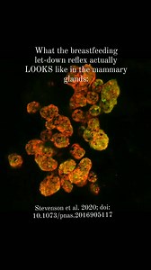 How amazing is this video of the let-down reflex in the mammary glands. Some describe it as a tingly sensation, pins and needles, or warmth. Many women don’t feel anything at all and some have experienced different sensations with different nurslings? Did you feel your let-down? Video from @allsourcepregnancy https://instagram.com/allsourcepregnancy?utm_medium=copy_link | Tivity