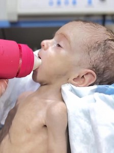 New update of Baby Abubakar: This cute little fighter is melting hearts again with his strength and innocence in NICU. His journey continues to inspire hope and love. Please keep him in your prayers as he fights bravely every day. #AbubakarBaby​ #CuteBaby​ #NICUBaby​ #NewUpdate​ #MeltingHearts​ #BabyInNICU​ #TinyFighter​ #BabyRecovery​ #NICUCare​ #PrayForAbubakar​ #InnocentBaby | Nurse Life