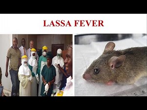 Lassa Hemorrhagic Fever || Lassa Fever || Cause, Symptoms, Diagnosis & Prevention of Lassa Fever