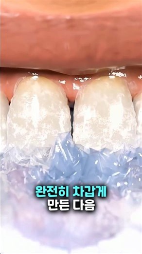 얼어붙은 치아로 뜨거운 커피를 마시면 치아가 부러질 수 있어요