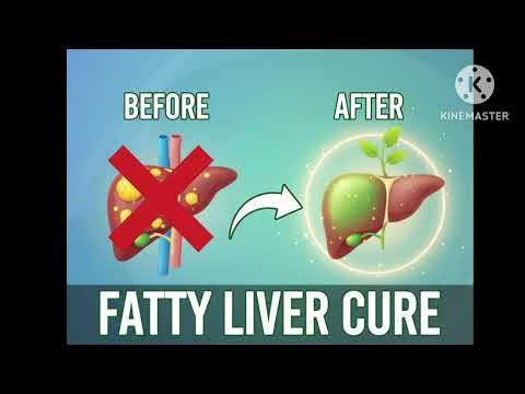 Fatty liver cure | cure fatty liver with this subliminal #subliminal