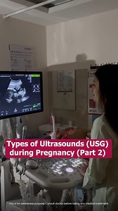 Ever wondered what a Dating Scan is in pregnancy? This ultrasound helps determine your baby’s gestational age, expected due date, and overall early development — giving you a clearer picture of your pregnancy journey. Ft. Dr. Bakul, Indira IVF Ludhiana Book a free consultation: 18003094405 [Dating scan, types of ultrasound, pregnancy scan, early pregnancy, due date scan, Ludhiana IVF, Indira IVF] #IndiraIVF #UnexplainedInfertility #IVFTreatment #ICSIProcedure #FertilitySolutions #HopeForParentho
