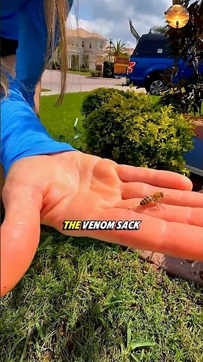What to Do Immediately After a Bee Sting 😳🐝🧊