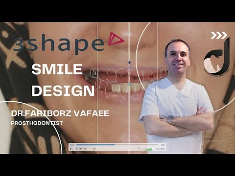 Smile design tutorial in 3shape unite (part1)