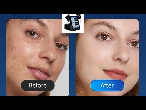 Professional Face Lifting & Wrinkle Removal Machine