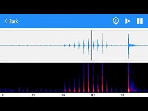 Korotkoff sounds during blood pressure measurement recorded with Stemoscope