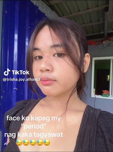 Dealing with Acne During Menstruation: Tips and Advice