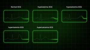 clip-3458570871-types-ecg-electrocardiogram-3d-rendered-video-clip