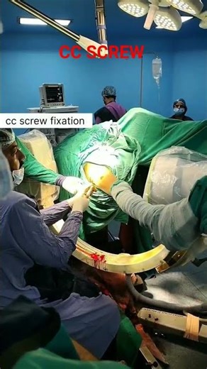 CC SCREW #viral #ytstudioes #ottechnician #education