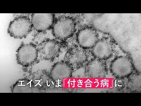 エイズ、「死の病」はいま「付き合う病」に 残る偏見も