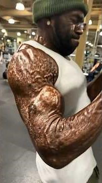 Bad Teeth Kills People