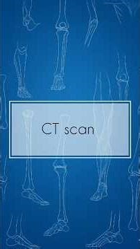 CT scan 🦴 | Bone series