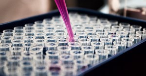 Uber Box Is a Home STD Test That’s Simple, Painless, Convenient, & Private