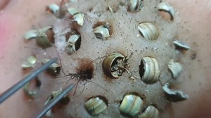 9.8K views · 64 reactions | Extremely plucking Facial Cleaning And Remove, How is a Lovely video 2025 10 27 23 24 32 | Amy August | Facebook