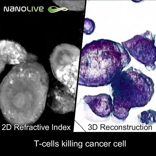 Label free live cell imaging t cells killing cancer cells