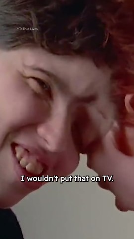 Conjoined twin comes out as trans 🏳️‍⚧️