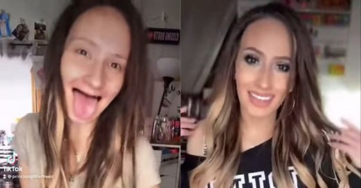 Woman whose teeth decayed during pregnancy shows off her dentures and toothless smile in viral video - WATCH