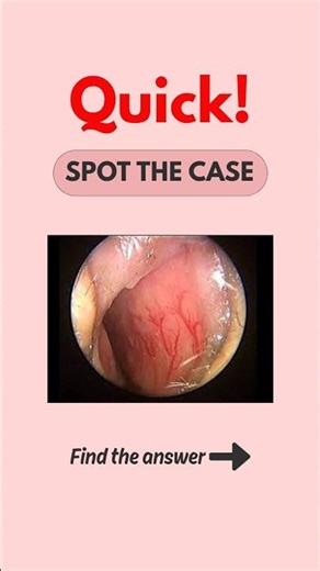 ENT Spot the Case #neetpg #pgentranceexam #theentresident